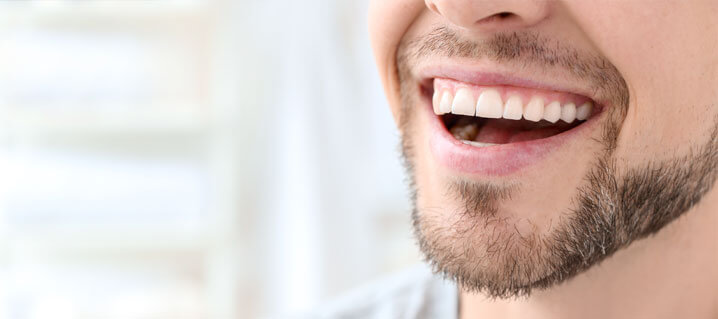 How To Fix Crooked Teeth
